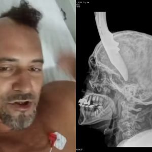 Eletricista tem canivete cravado na cabeça após discussão com cunhado