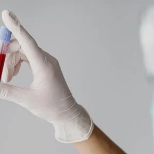 Doenças do sangue: Dr. Kalil e hematologistas detalham sinais precoces