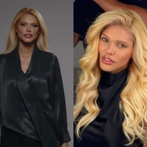 Ex-miss mato-grossense participa de reality de harmonização facial 'Beleza Garantida'