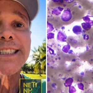 Entenda o que é o linfoma não Hodgkin, câncer que levou Netinho a ser internado em Salvador