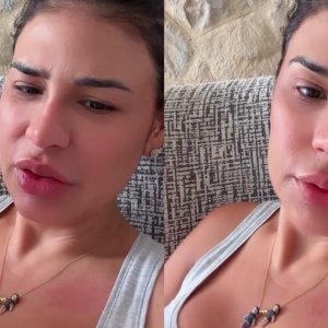 Simone Mendes atualiza recuperação de cirurgia para retirar excesso de pele