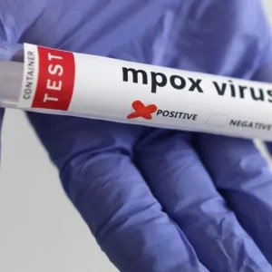 Rio de Janeiro registra 74 casos de Mpox em dois meses